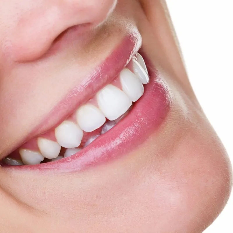 pulizia-dentale-professionale-studio-dentistico-cera-casarano