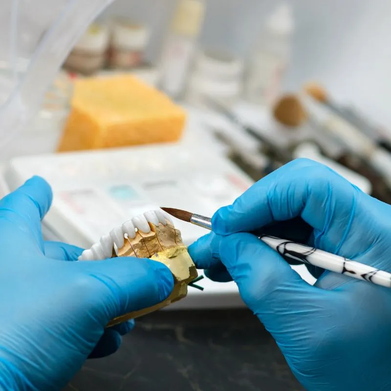 ricostruzioni dentali a casarano dentista specializzato